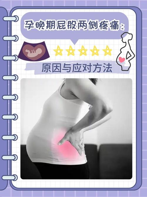 孕期屁股抽筋是缺钙还是压迫神经？该怎么缓解才安全？-第2张图片-郑州医学网