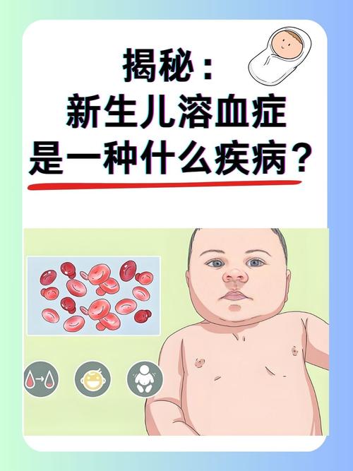 新生儿溶血有哪些早期症状？如何通过检查确诊？-第1张图片-郑州医学网