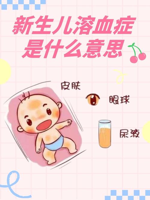 新生儿溶血有哪些早期症状？如何通过检查确诊？-第3张图片-郑州医学网