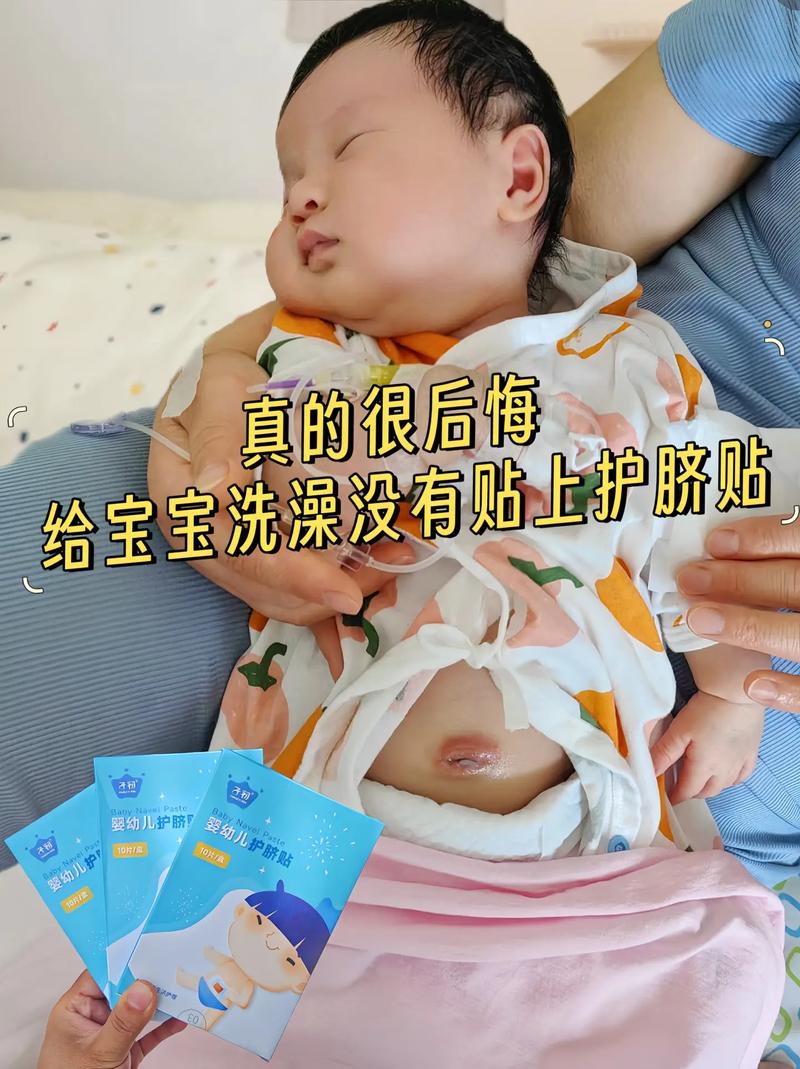 新生儿肚脐护理时喷的药水具体叫什么名字？-第1张图片-郑州医学网