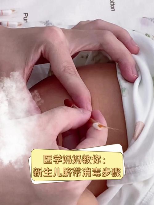 新生儿肚脐消毒的正确方法与注意事项有哪些？-第3张图片-郑州医学网