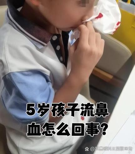 5岁孩子总流鼻血是上火还是生病？家长该怎么处理才正确？-第3张图片-郑州医学网