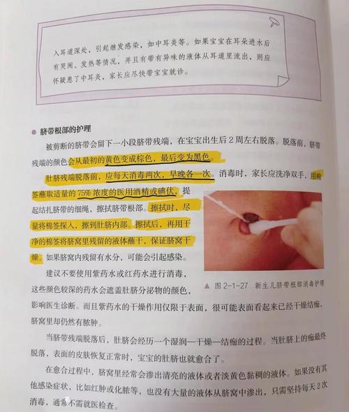 新生儿肚脐眼消毒到底该怎么做才正确？-第1张图片-郑州医学网