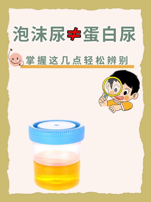 新生儿尿液颜色异常有哪些表现？正常尿液颜色范围是多少？-第2张图片-郑州医学网