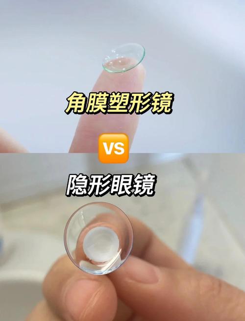 儿童角膜塑形镜真的安全有效吗？长期佩戴会有哪些风险或后遗症？-第2张图片-郑州医学网