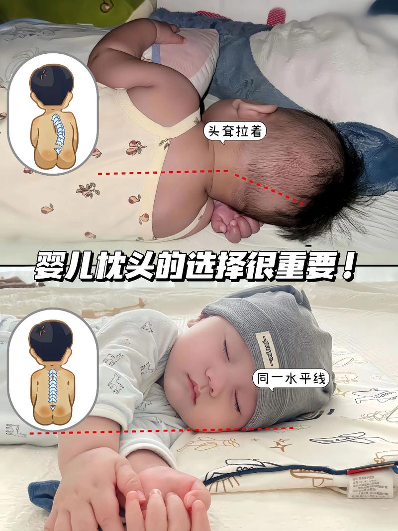 新生儿到底多大才适合垫枕头？过早使用会不会影响颈椎发育？-第2张图片-郑州医学网