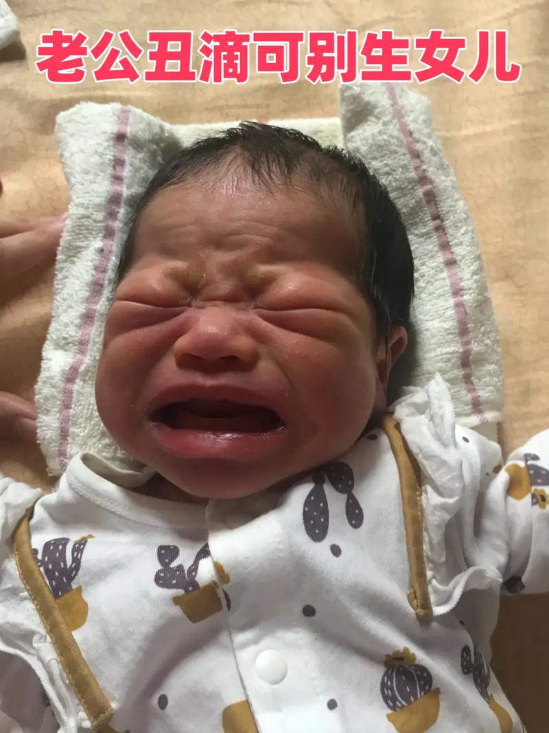 为什么新生儿宝宝出生后会变丑？这些丑照背后的真相是什么？-第3张图片-郑州医学网