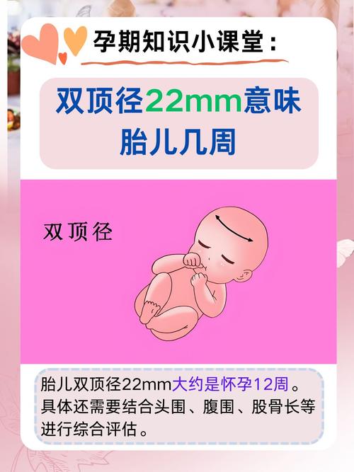 孕期如何准确检查双性胎儿？产检项目有哪些？何时能发现？-第1张图片-郑州医学网