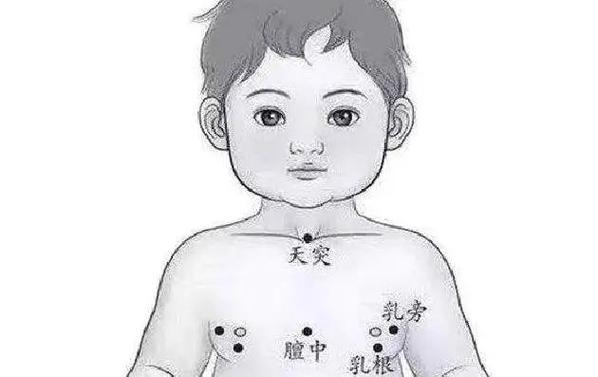 儿童脾虚拔罐位置图，哪些穴位安全有效？家长如何正确操作？-第3张图片-郑州医学网