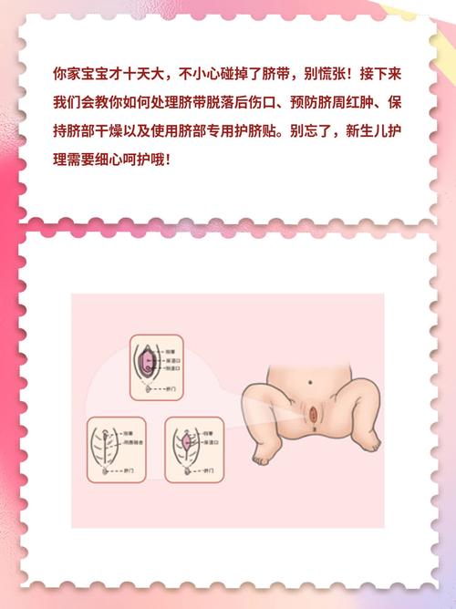 新生儿脐带迟迟不脱落，家长该如何正确护理和处理？-第1张图片-郑州医学网