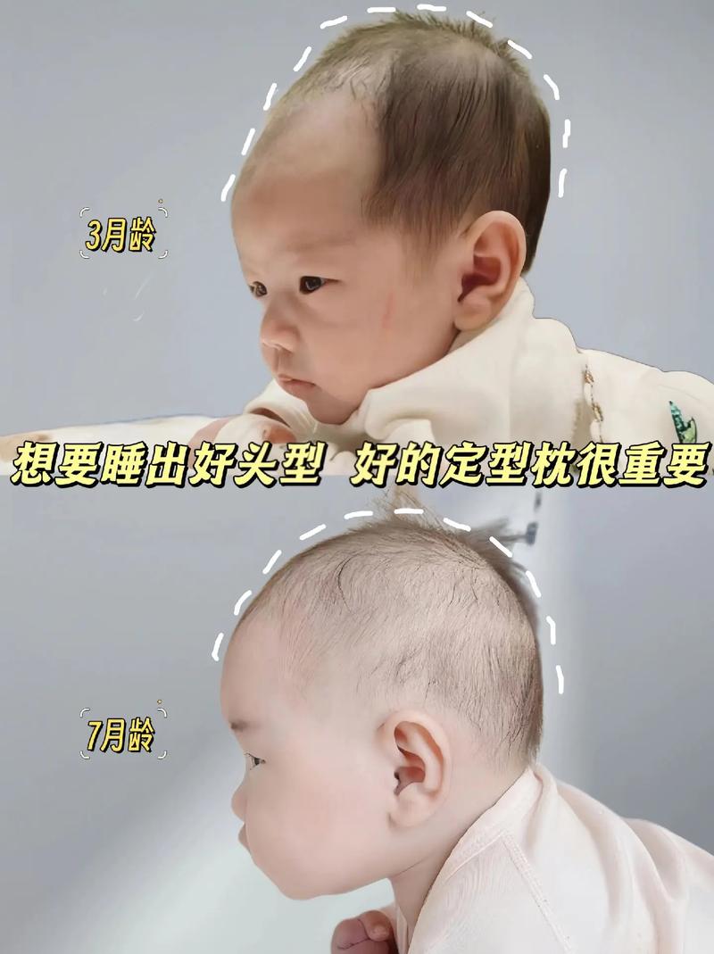 新生儿老是喜欢歪头睡-第1张图片-郑州医学网