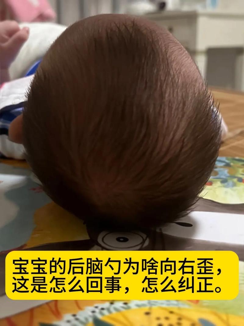 新生儿老是喜欢歪头睡-第3张图片-郑州医学网
