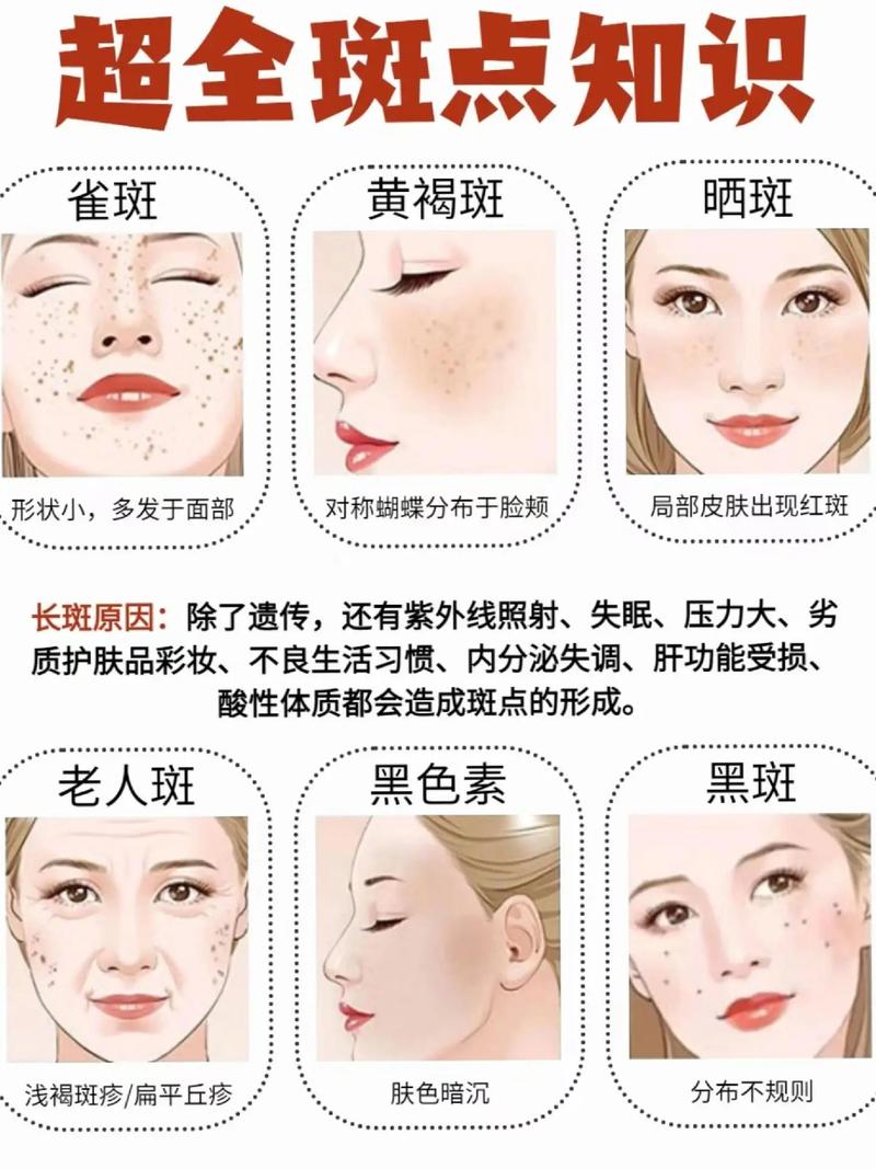 孕期脸上长斑怎么防？这些科学方法准妈妈必看！-第2张图片-郑州医学网