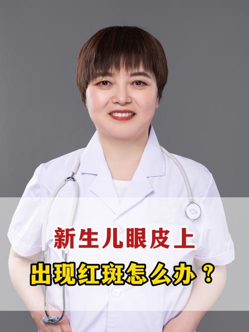 新生儿眼角红斑会自行消退吗？需要干预吗？-第1张图片-郑州医学网