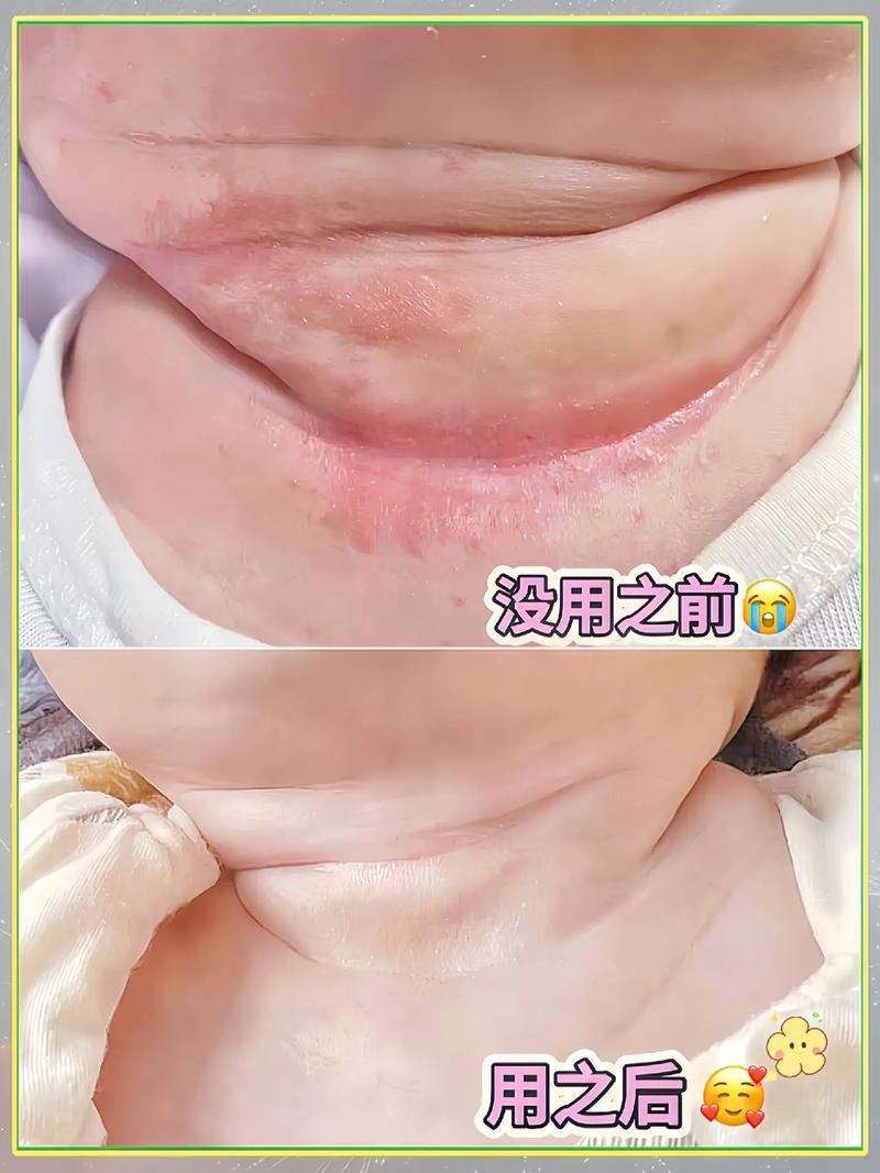 新生儿脖子淹了摸香油？这种土方法真的安全有效吗？-第1张图片-郑州医学网